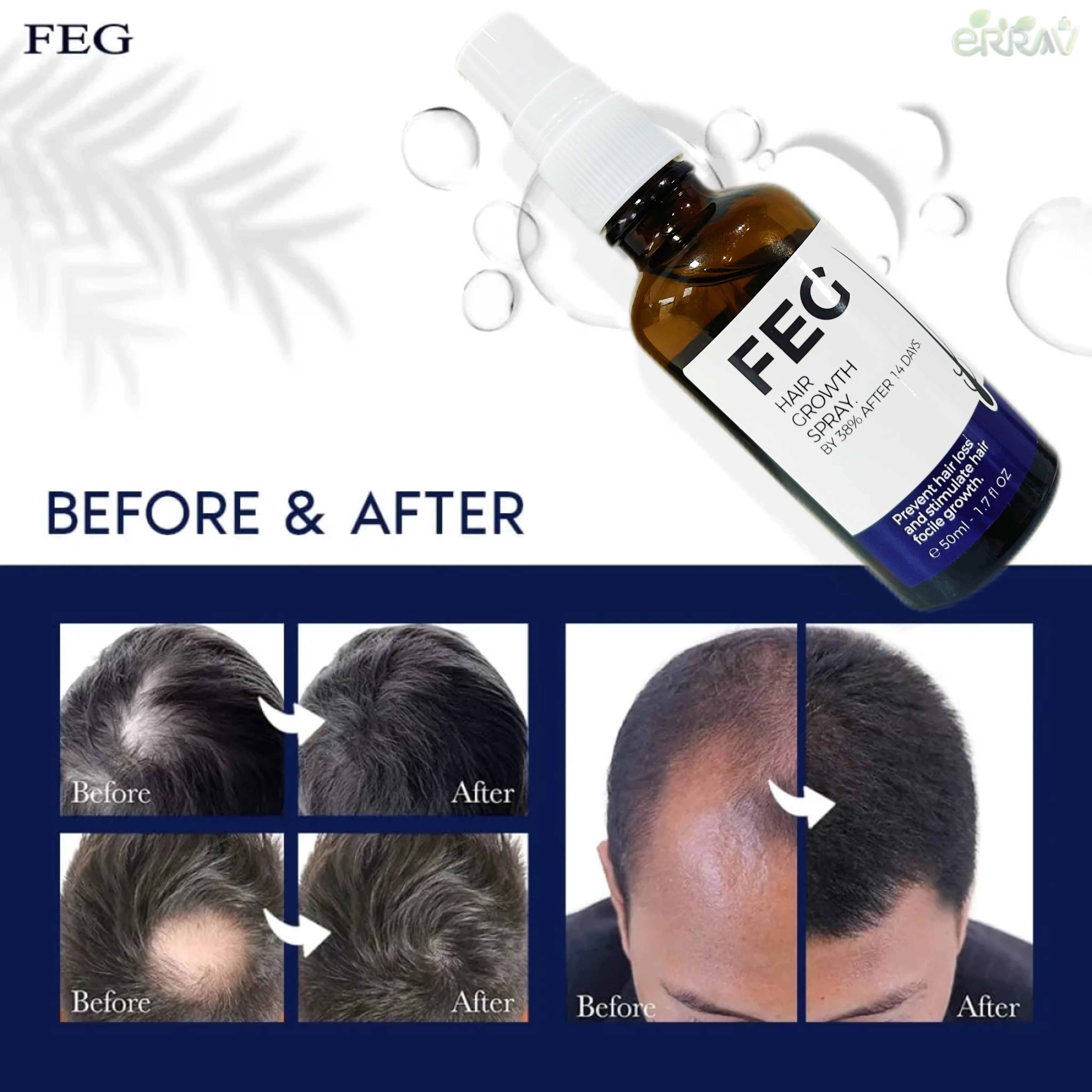 FEG Original Hair Growth Spray - 50 ml Moisturizing Care Solution